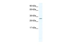 Aviva Systems Biology Corp APEX1 Antibody - N-terminal region (ARP37013_T100)