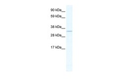 Aviva Systems Biology Corp APEX1 Antibody - N-terminal region (ARP37014_T100)