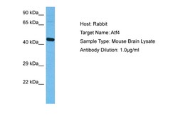 Aviva Systems Biology Corp ATF4 Antibody - N-terminal region (ARP37017_P050)