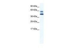 Aviva Systems Biology Corp ZBTB7A Antibody - N-terminal region (ARP37084_T100)