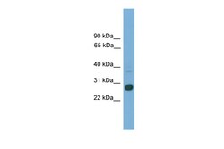 Aviva Systems Biology Corp Mxd1 Antibody - C-terminal region (ARP37086_P050)