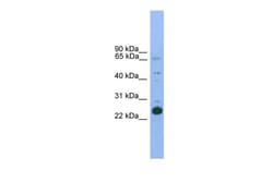 Aviva Systems Biology Corp Nkx2-6 Antibody - N-terminal region (ARP37112_P050)