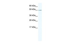 Aviva Systems Biology Corp KHDRBS1 Antibody - N-terminal region (ARP37130_T100)