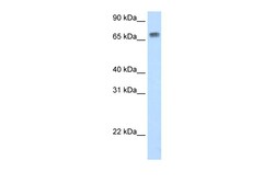 Aviva Systems Biology Corp Mta2 Antibody - N-terminal region (ARP37167_T100)