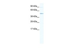 Aviva Systems Biology Corp SITPEC Antibody - middle region (ARP37176_T100)