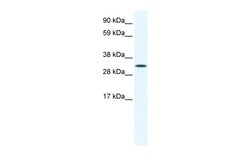 Aviva Systems Biology Corp AIP Antibody - N-terminal region (ARP37219_T100)