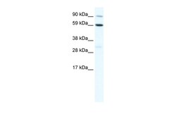 Aviva Systems Biology Corp TBX21 Antibody - C-terminal region (ARP37251_T100)