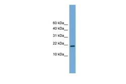 Aviva Systems Biology Corp Cited4 Antibody - middle region (ARP37254_P050)