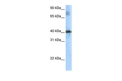 Aviva Systems Biology Corp Tsc22d4 Antibody - N-terminal region (ARP37339_T100)