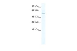 Aviva Systems Biology Corp LASS4 Antibody - N-terminal region (ARP37354_T100)