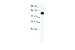 Aviva Systems Biology Corp E130307M08RIK Antibody - middle region (ARP37366_T100)