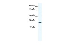 Aviva Systems Biology Corp BRF1 Antibody - C-terminal region (ARP37387_T100)