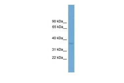 Aviva Systems Biology Corp Zfp444 Antibody - C-terminal region (ARP37390_P050)