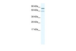 Aviva Systems Biology Corp PARN Antibody - N-terminal region (ARP37393_T100)