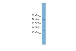 Aviva Systems Biology Corp Pbx4 Antibody - N-terminal region (ARP37406_P050)