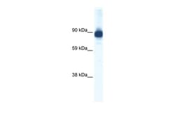 Aviva Systems Biology Corp ACTN2 Antibody - C-terminal region (ARP37422_T100)