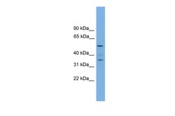 Aviva Systems Biology Corp Nobox Antibody - middle region (ARP37450_P050)