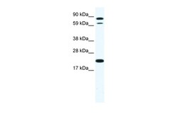 Aviva Systems Biology Corp ZFP287 Antibody - N-terminal region (ARP37453_T100)