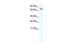 Aviva Systems Biology Corp CES6 Antibody - middle region (ARP37467_T100)