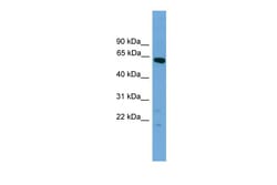Aviva Systems Biology Corp Tbx22 Antibody - N-terminal region (ARP37488_P050)