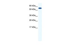 Aviva Systems Biology Corp CBFA2T2H Antibody - middle region (ARP37525_P050)