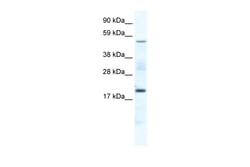 Aviva Systems Biology Corp CSNK1G1 Antibody - middle region (ARP37531_T100)