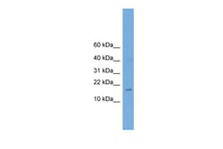 Aviva Systems Biology Corp A830053O21Rik Antibody - middle region (ARP37562_P050)