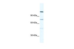Aviva Systems Biology Corp D930005D10RIK Antibody - C-terminal region (ARP37588_T100)