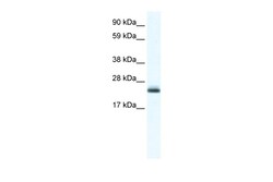 Aviva Systems Biology Corp Tppp Antibody - C-terminal region (ARP37599_T100)