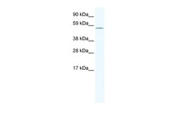 Aviva Systems Biology Corp HOMEZ Antibody - N-terminal region (ARP37601_T100)