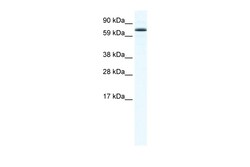 Aviva Systems Biology Corp FOXO6 Antibody - N-terminal region (ARP37610_T100)