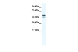 Aviva Systems Biology Corp TRF3 Antibody - N-terminal region (ARP37625_T100)