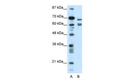 Aviva Systems Biology Corp KCNK5 Antibody - C-terminal region (ARP37679_P050)