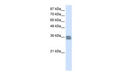 Aviva Systems Biology Corp CACNG4 Antibody - N-terminal region (ARP37694_T100)