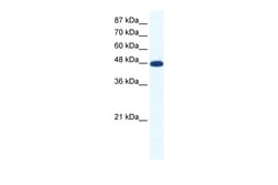 Aviva Systems Biology Corp ACCN5 Antibody - middle region (ARP37696_T100)