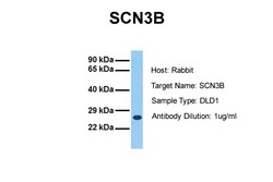 Aviva Systems Biology Corp SCN3B Antibody - N-terminal region (ARP37699_P050)