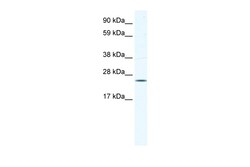 Aviva Systems Biology Corp KCTD6 Antibody - N-terminal region (ARP37706_T100)