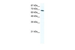 Aviva Systems Biology Corp DDX1 Antibody - C-terminal region (ARP37712_T100)
