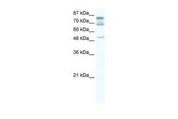 Aviva Systems Biology Corp DDX46 Antibody - C-terminal region (ARP37717_T100)