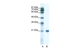 Aviva Systems Biology Corp SSX2 Antibody - C-terminal region (ARP37719_P050)