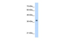 Aviva Systems Biology Corp LDB1 Antibody - C-terminal region (ARP37730_P050)