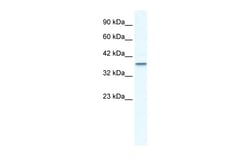 Aviva Systems Biology Corp MTA1 Antibody - C-terminal region (ARP37738_T100)