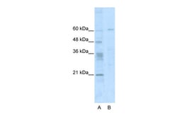 Aviva Systems Biology Corp ZNF192 Antibody - N-terminal region (ARP37750_P050)