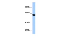 Aviva Systems Biology Corp ZNF350 Antibody - N-terminal region (ARP37781_P050)