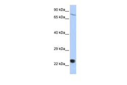 Aviva Systems Biology Corp SP110 Antibody - middle region (ARP37795_P050)