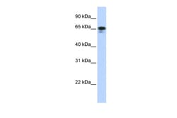 Aviva Systems Biology Corp ZNF276 Antibody - middle region (ARP37813_P050)