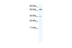 Aviva Systems Biology Corp ALX3 Antibody - N-terminal region (ARP37852_T100)