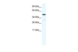Aviva Systems Biology Corp HOXA3 Antibody - N-terminal region (ARP37882_T100)