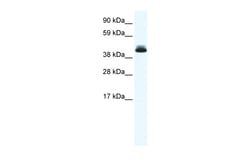 Aviva Systems Biology Corp PPARD Antibody - N-terminal region (ARP37889_T100)