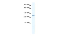 Aviva Systems Biology Corp SPIC Antibody - N-terminal region (ARP37892_T100)